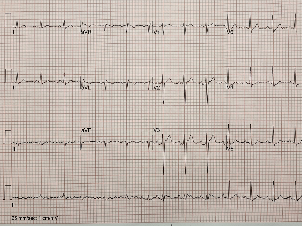Image for question 1173