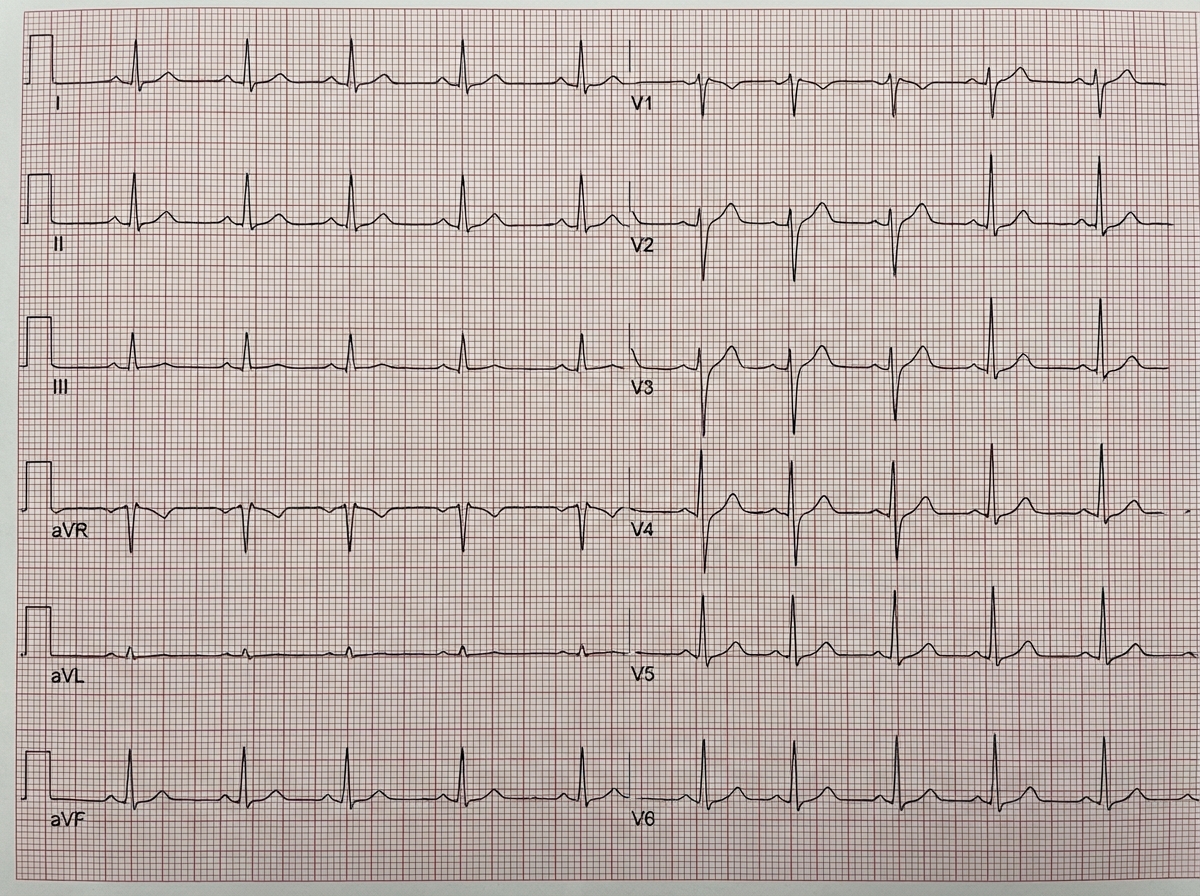 Image for question 952