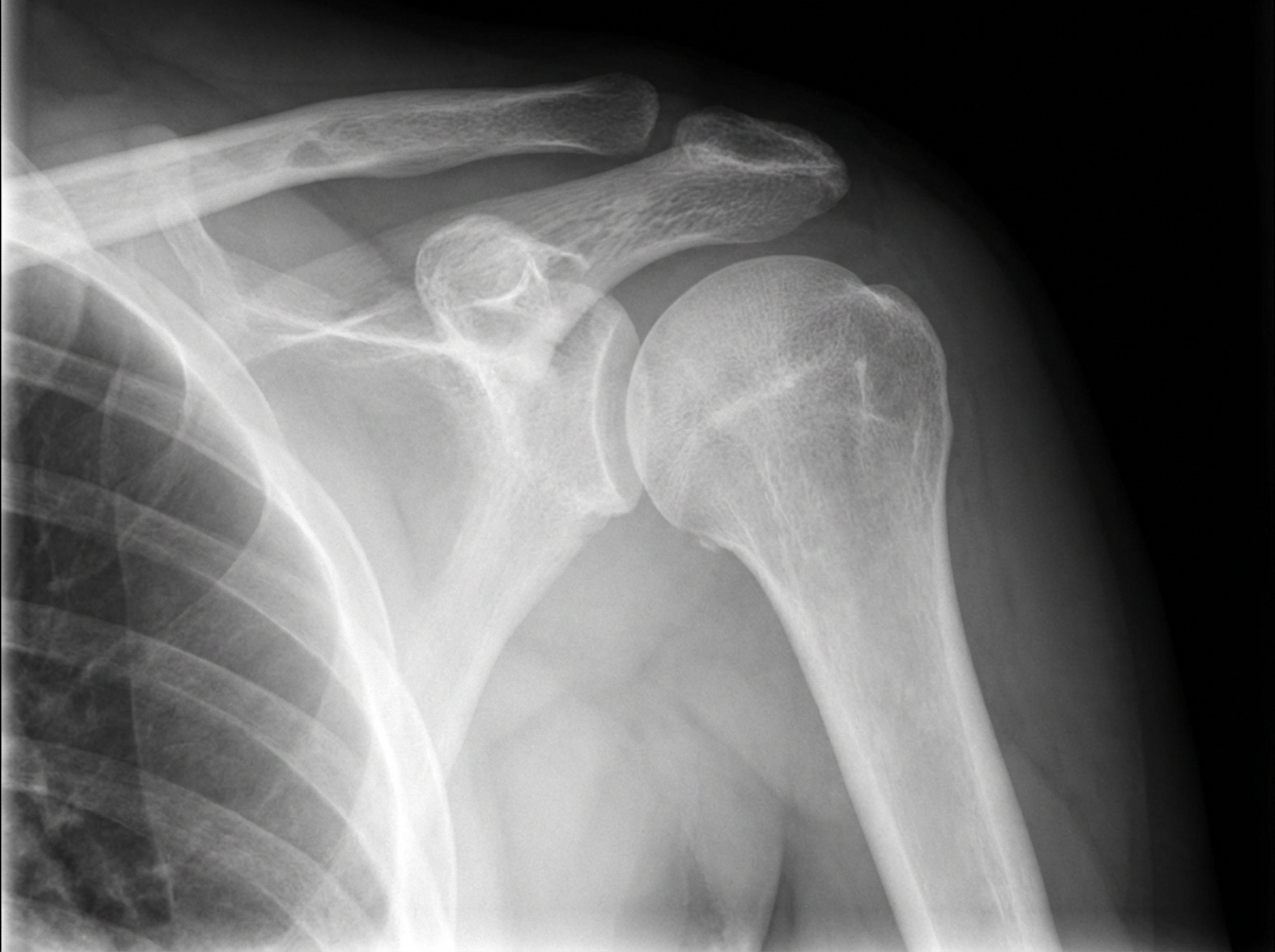 Image for question 247