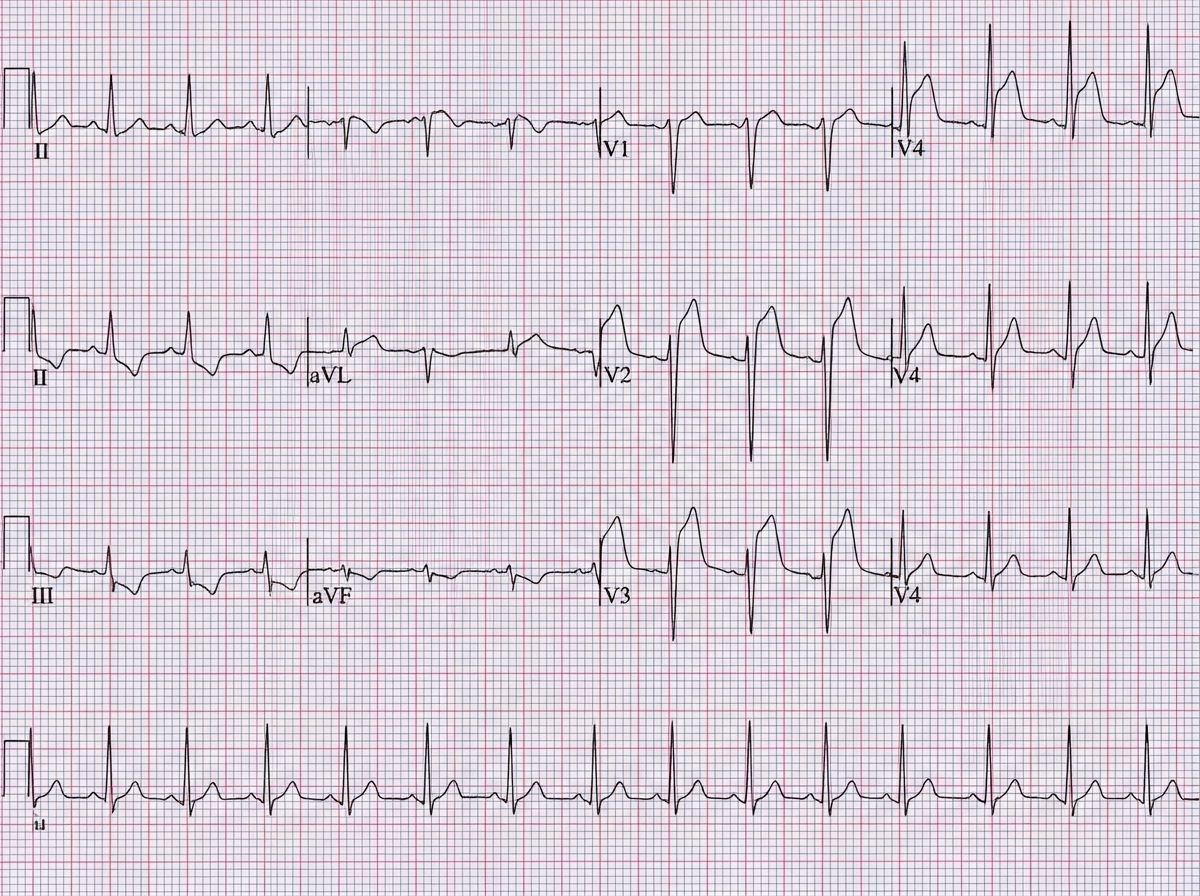 Image for question 34