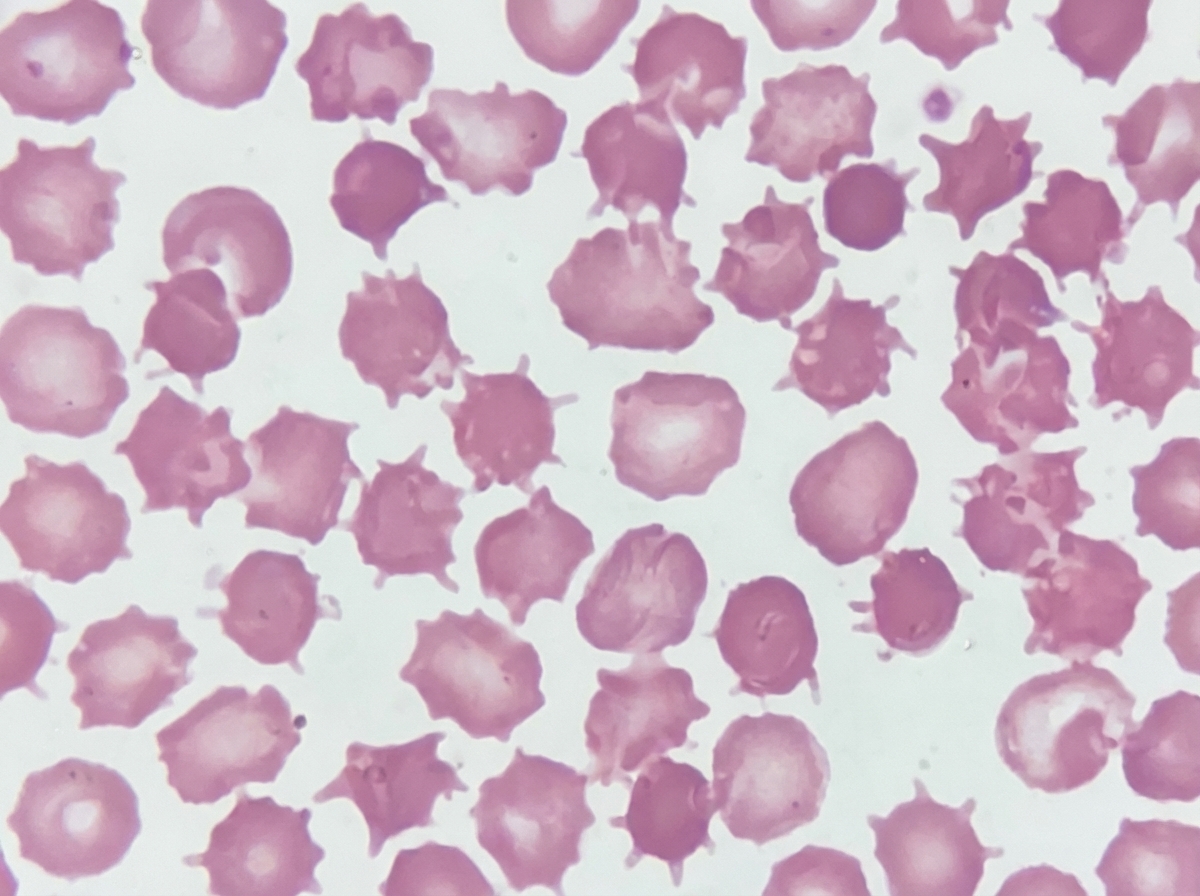 Image for question 175