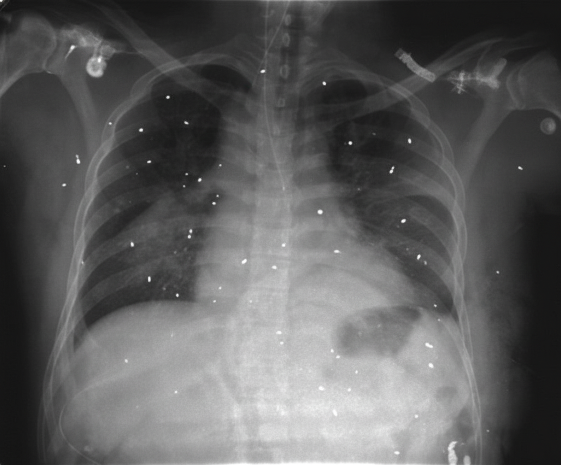 Image for question 65