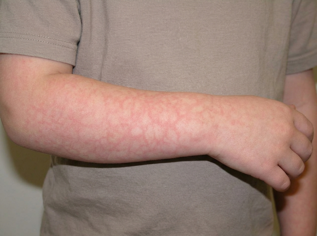 Image for question 173