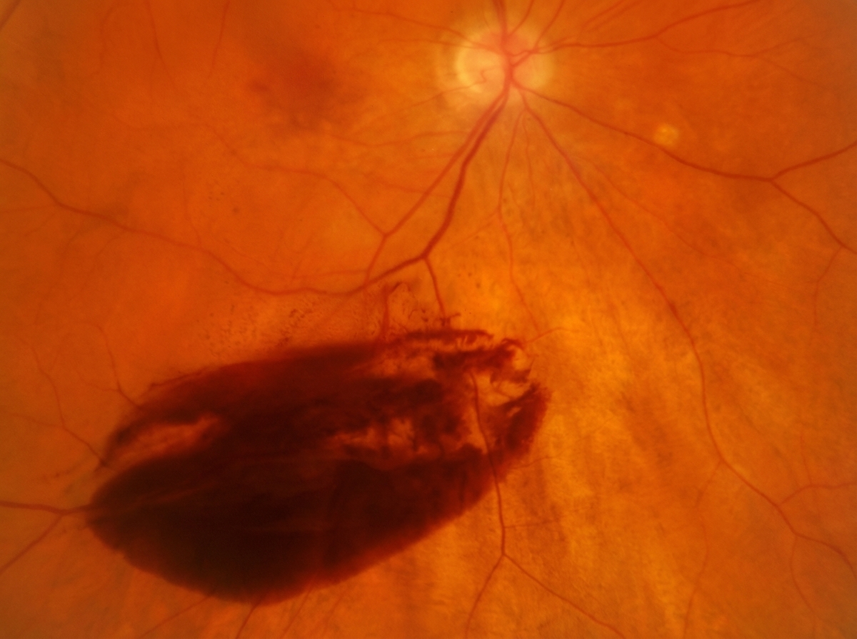 Image for question 398