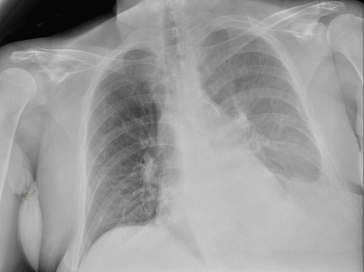 Image for question 140