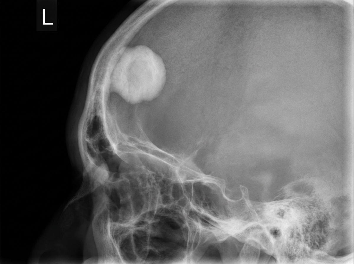 Image for question 76