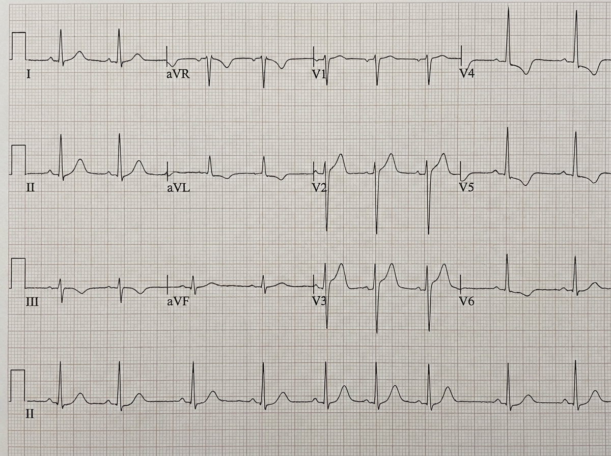 Image for question 536