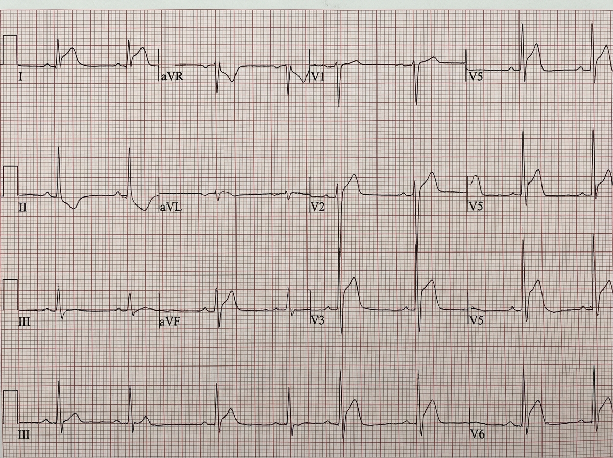 Image for question 36