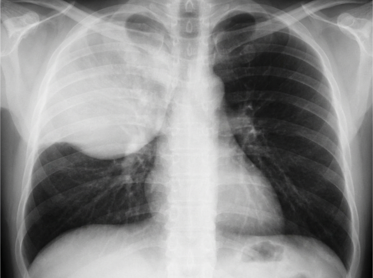 Image for question 572