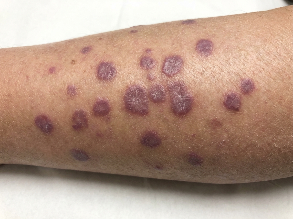 Image for question 1