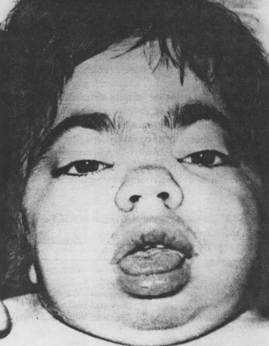 Image for question 93