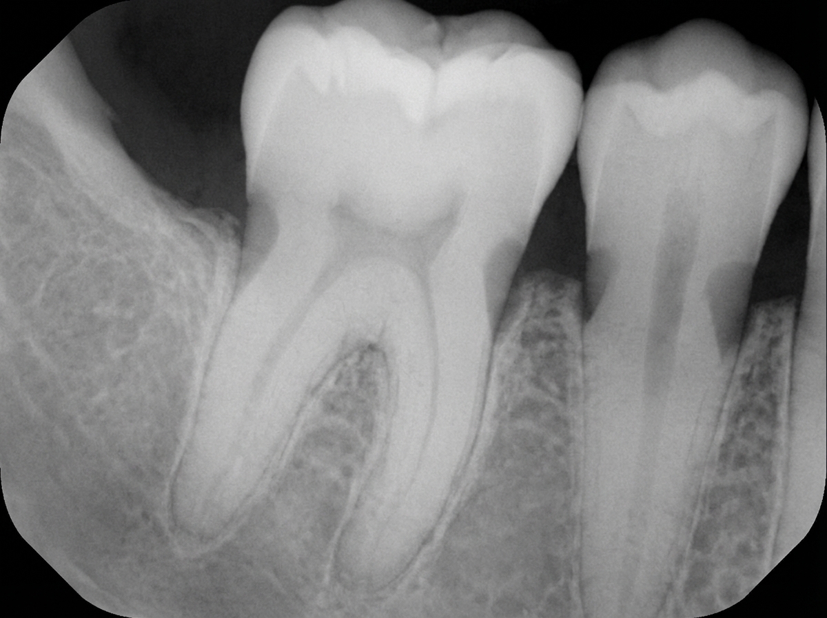 Image for question 2