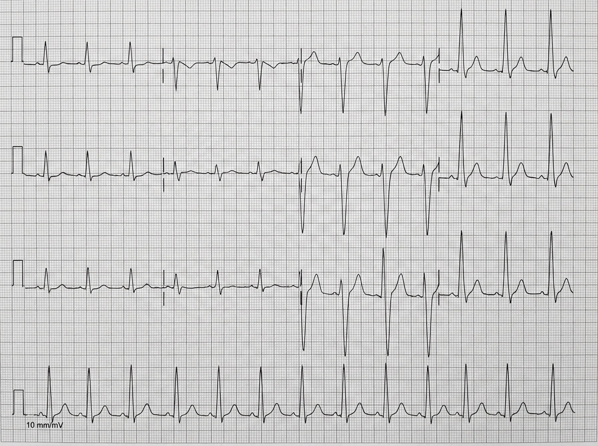 Image for question 208