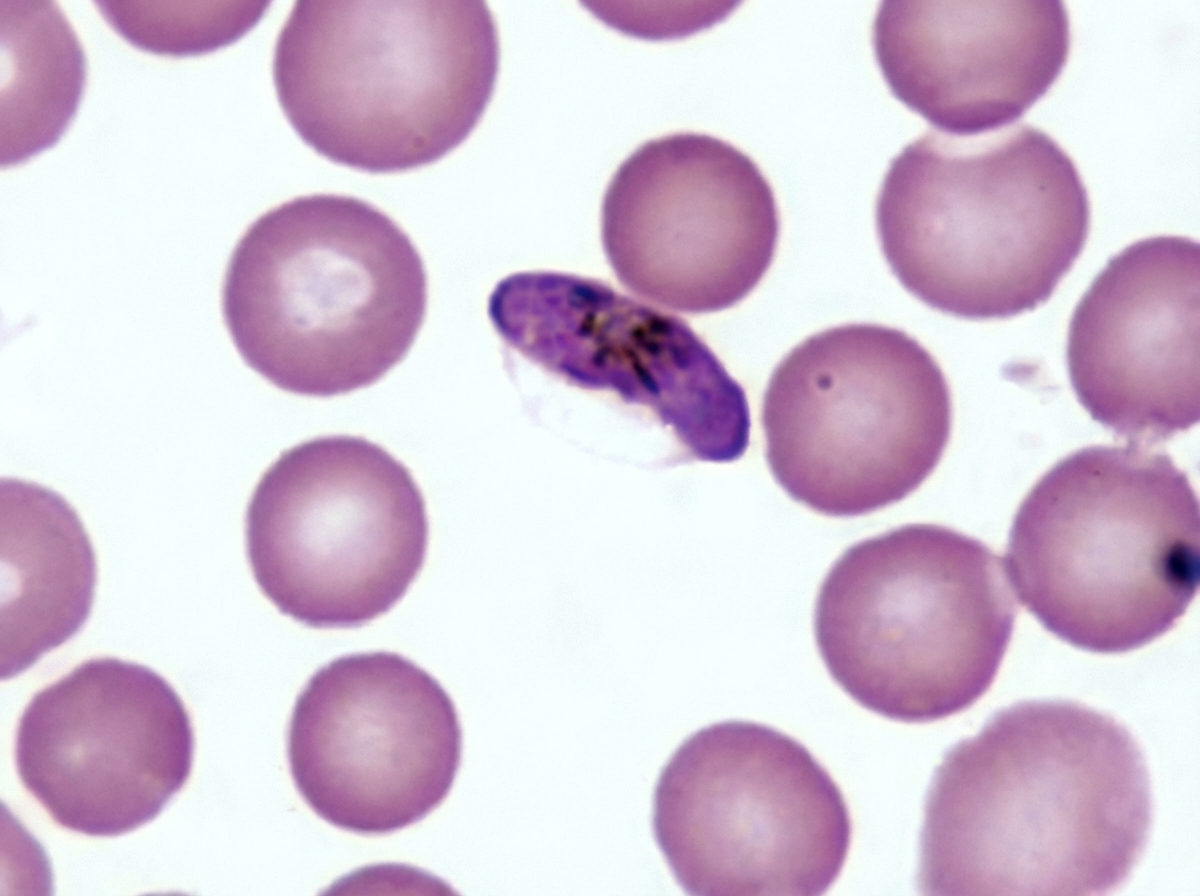 Image for question 1296