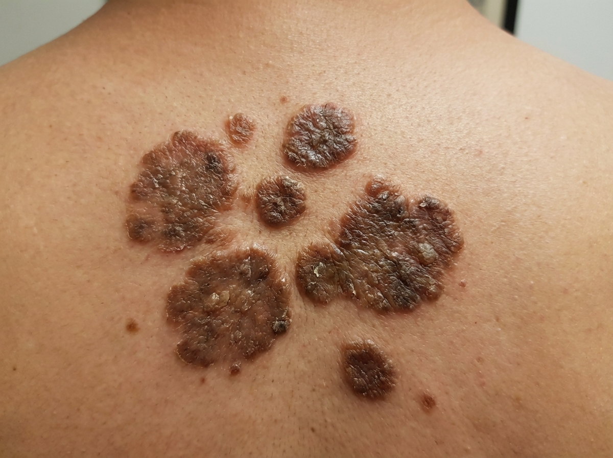 Image for question 15