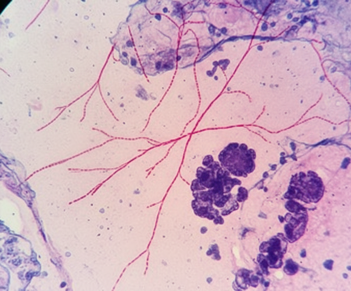 Image for question 152