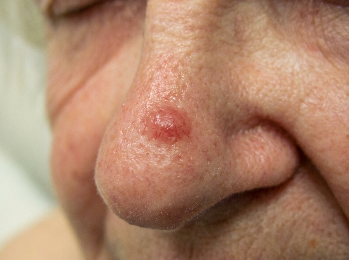 Image for question 201