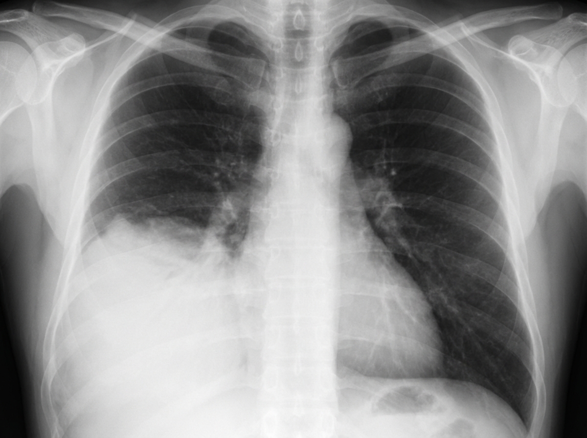 Image for question 104