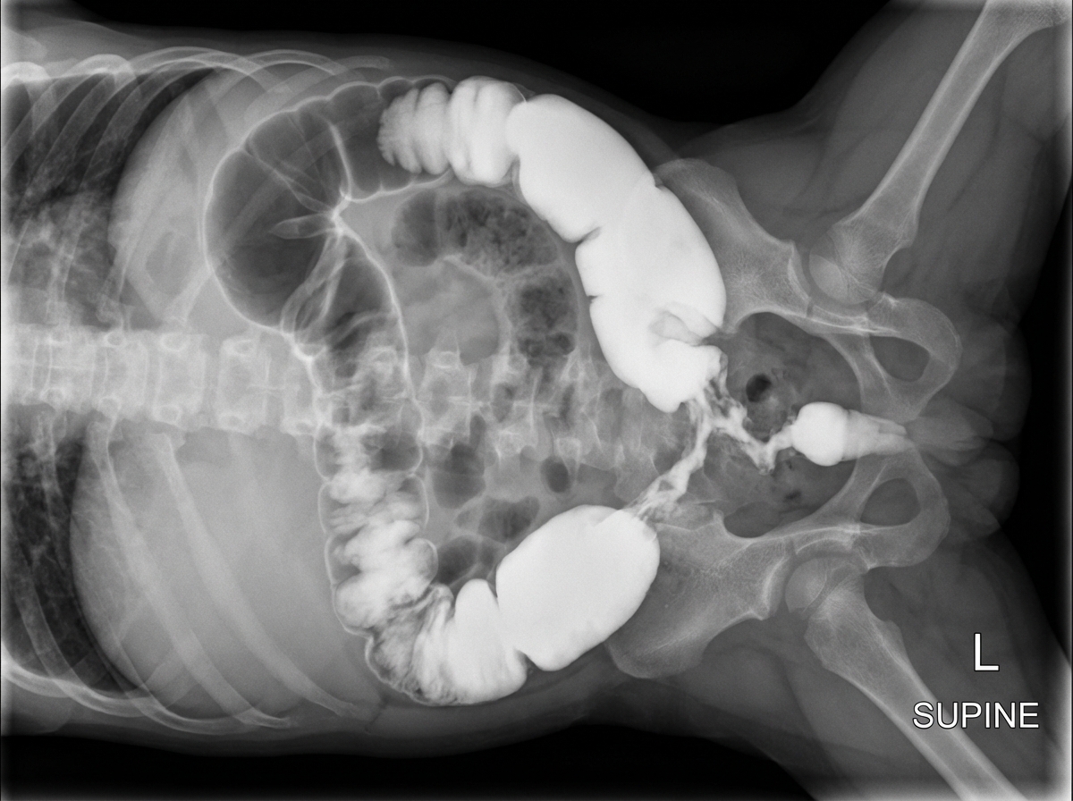 Image for question 151