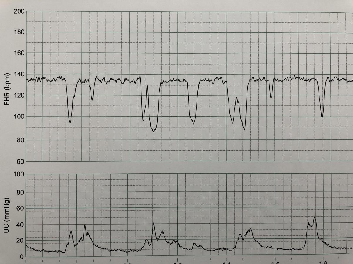 Image for question 252