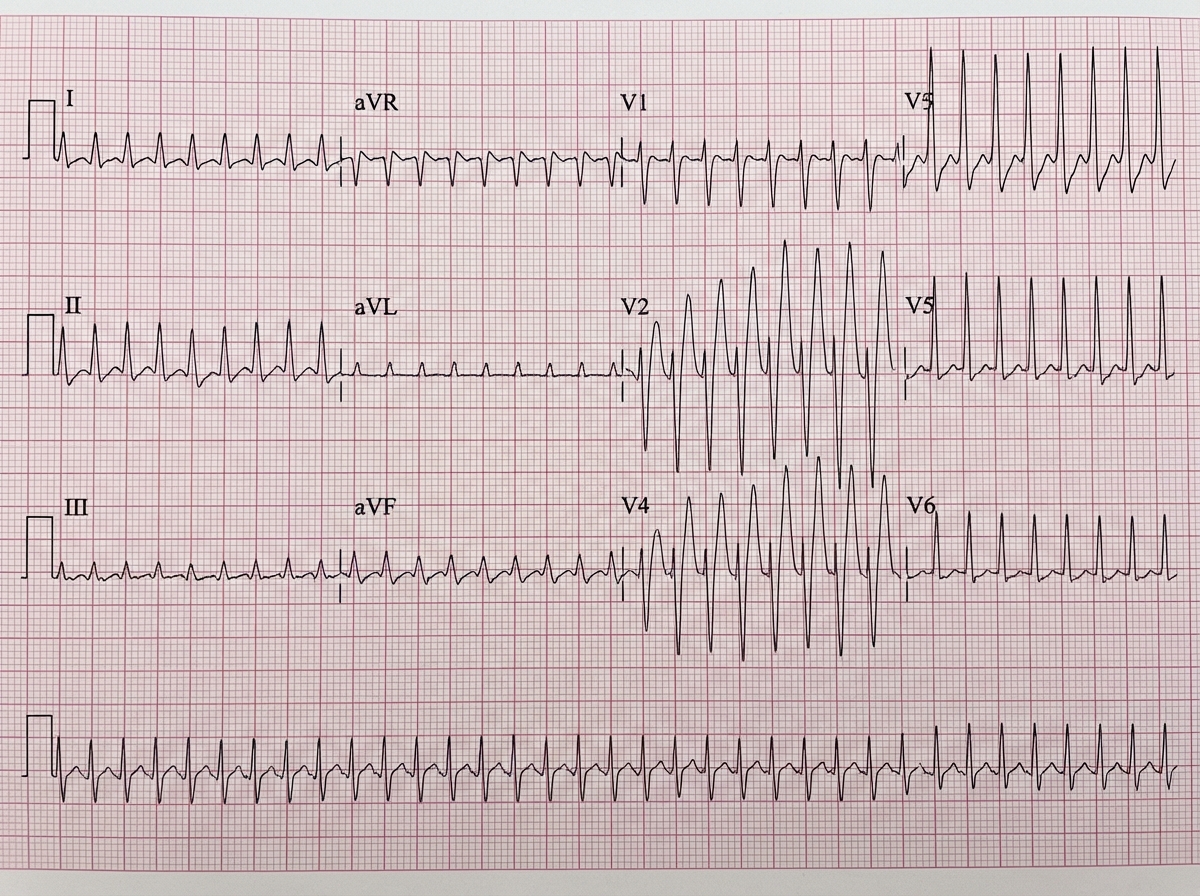 Image for question 1043