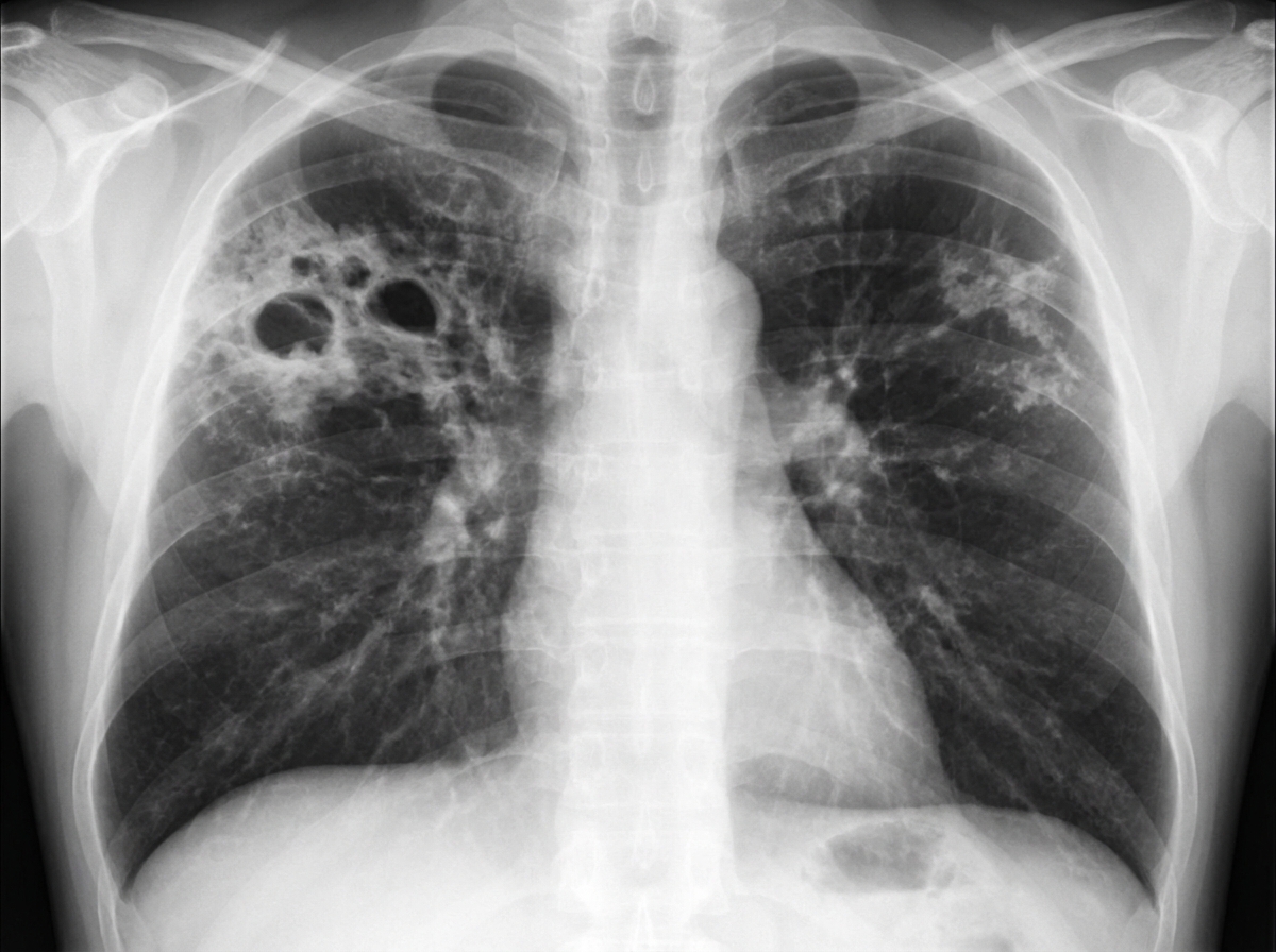 Image for question 515