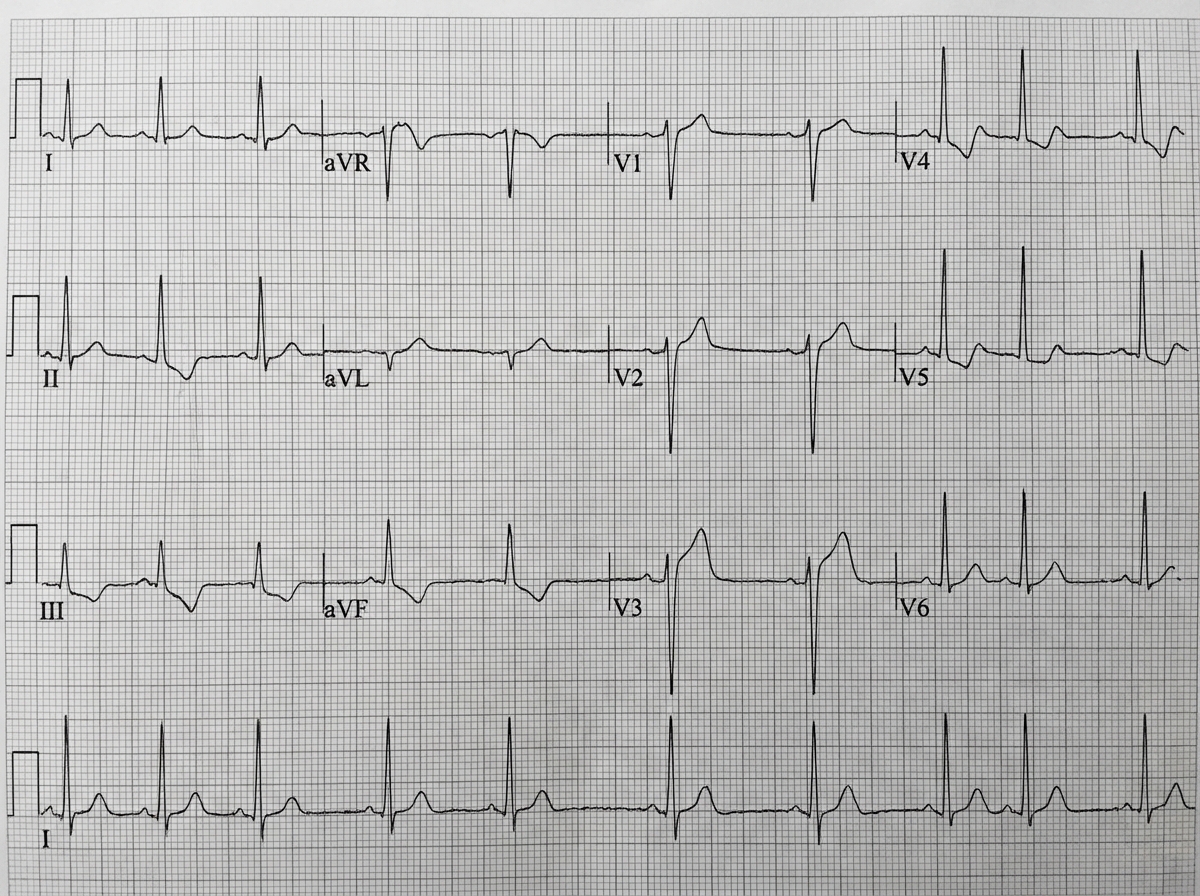 Image for question 1