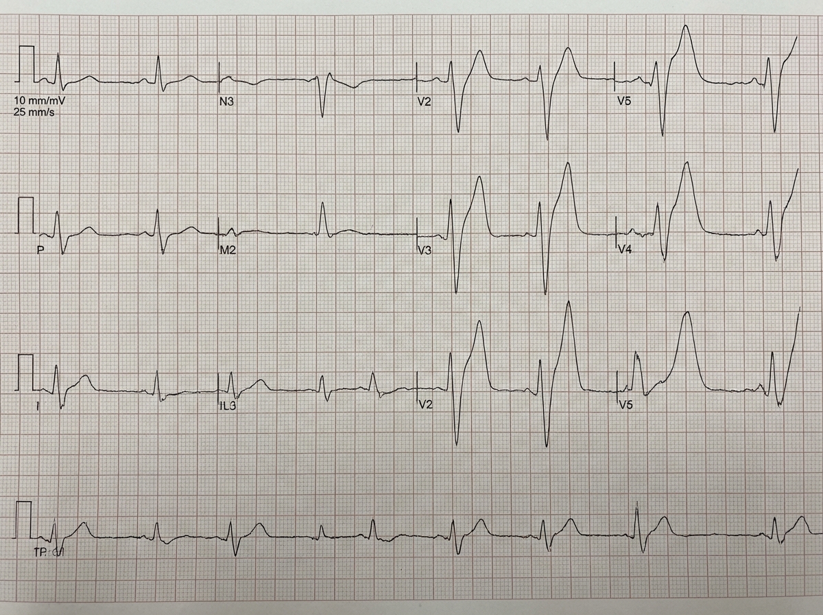 Image for question 38