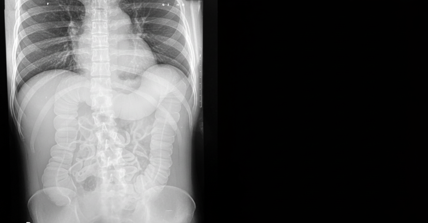 Image for question 576