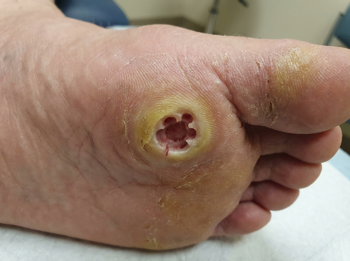 Image for question 657