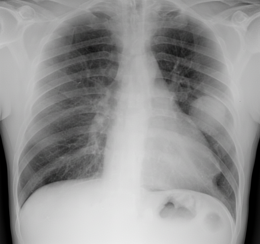 Image for question 536