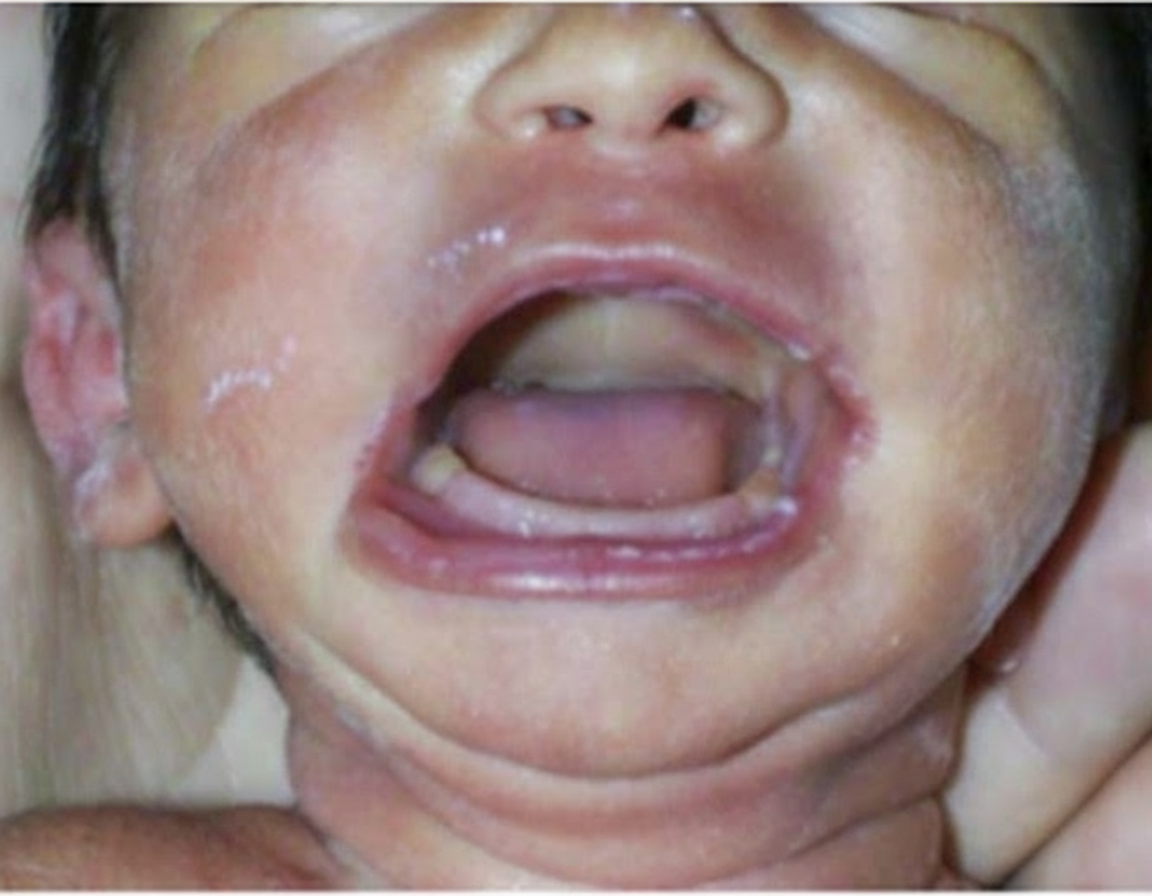 Image for question 820