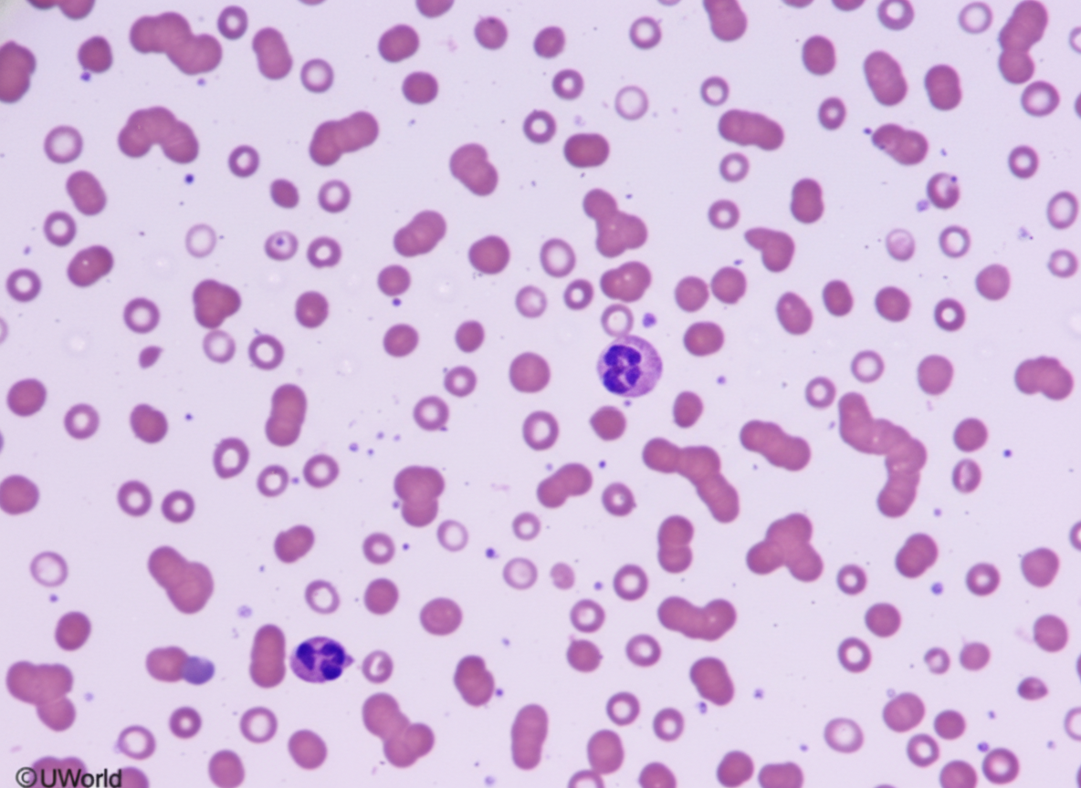 Image for question 1059