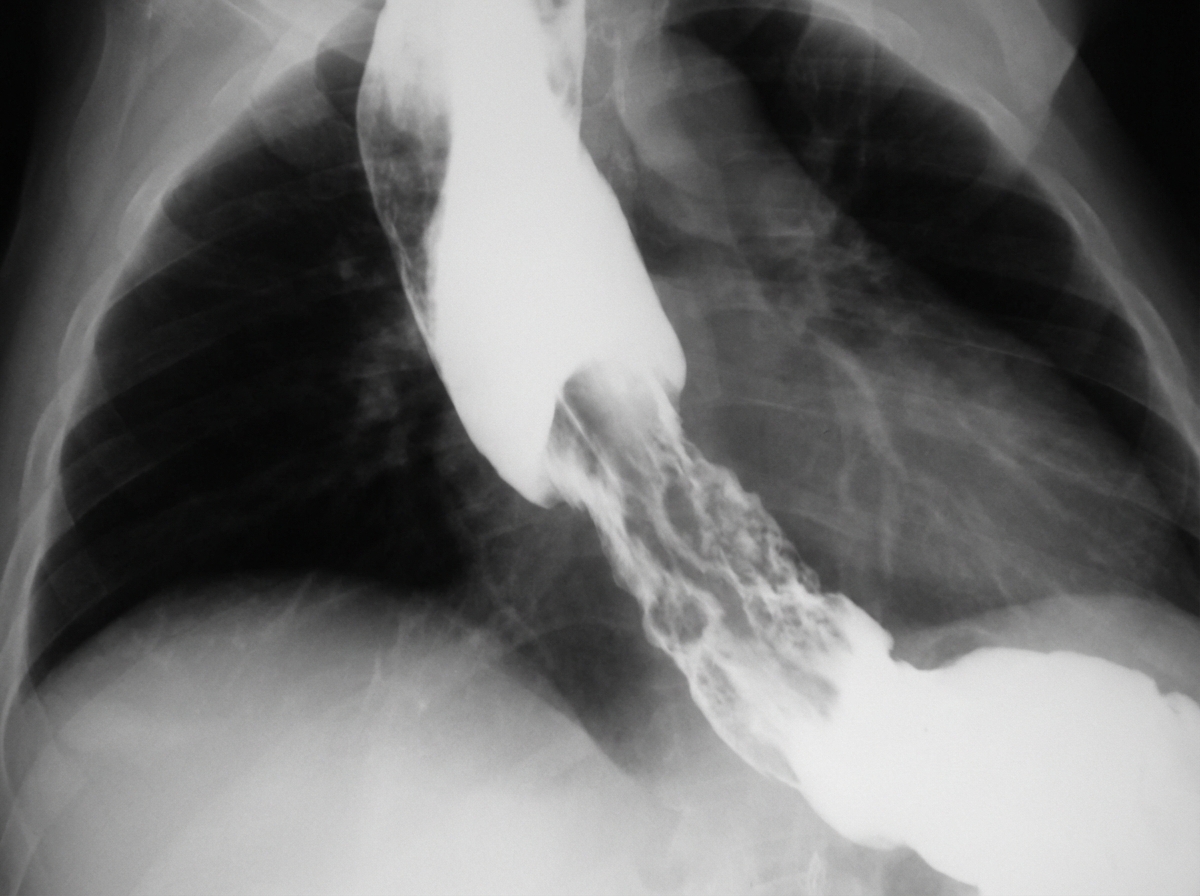 Image for question 133