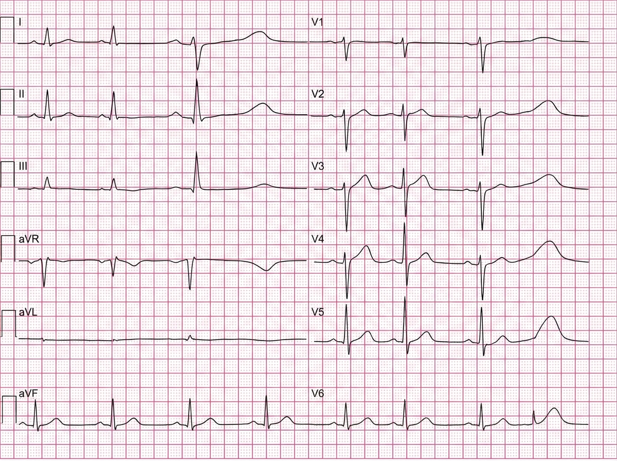 Image for question 6