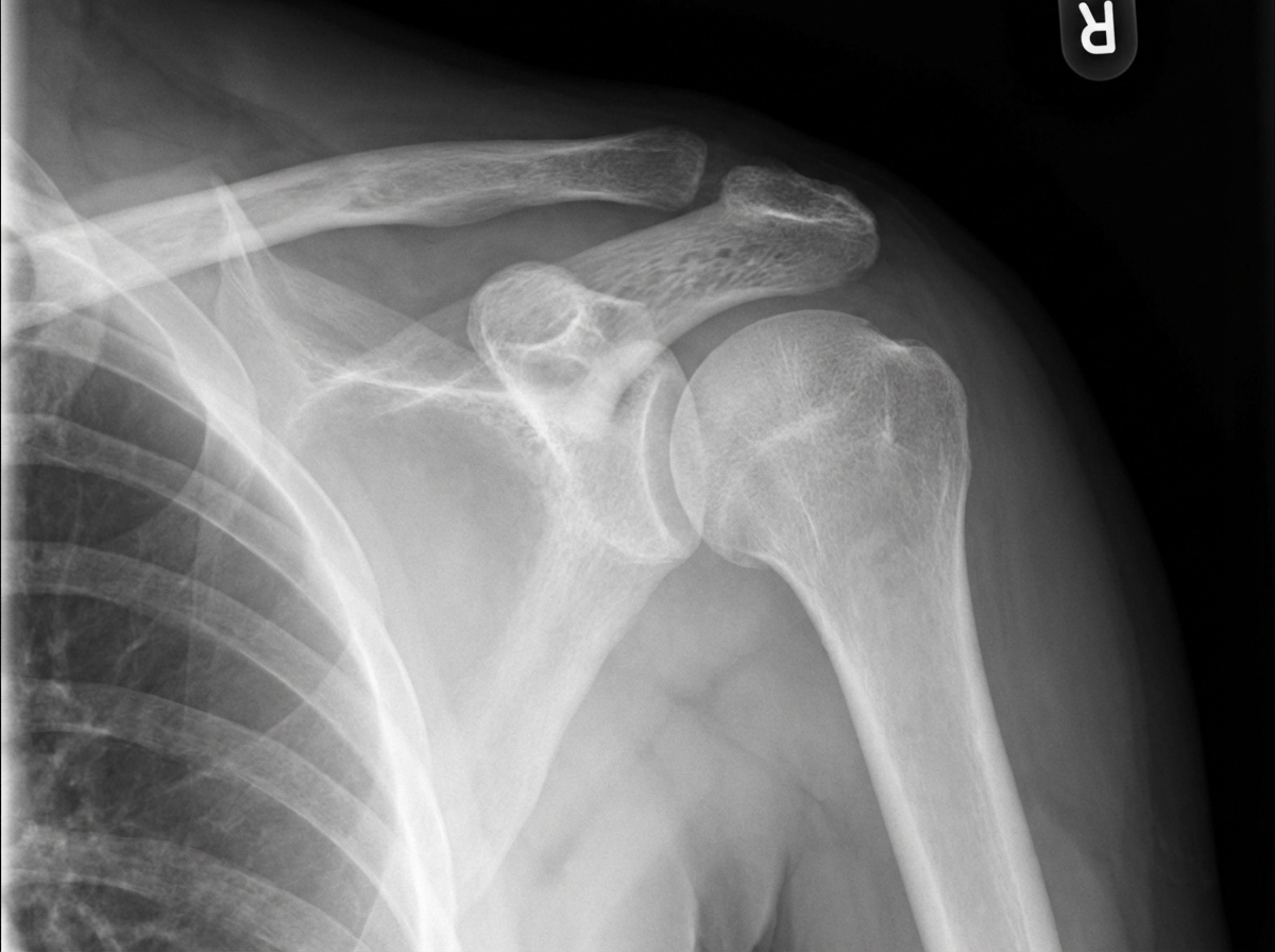 Image for question 851