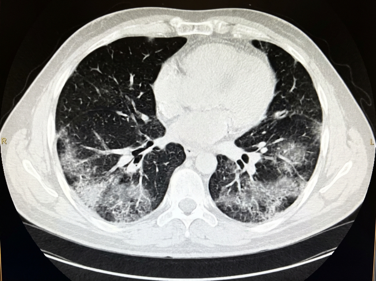 Image for question 67