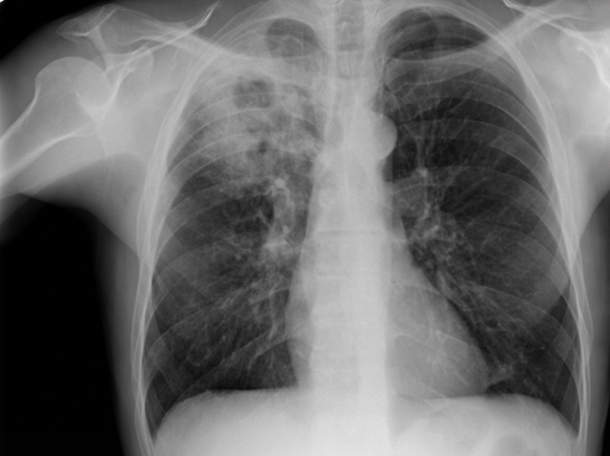 Image for question 1145