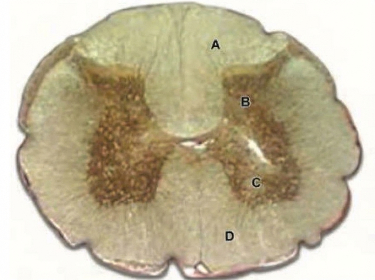 Image for question 61
