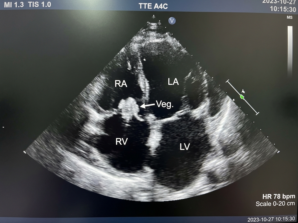 Image for question 561