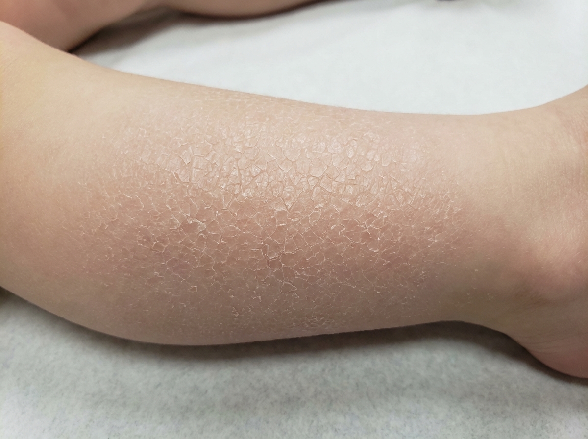 Image for question 106