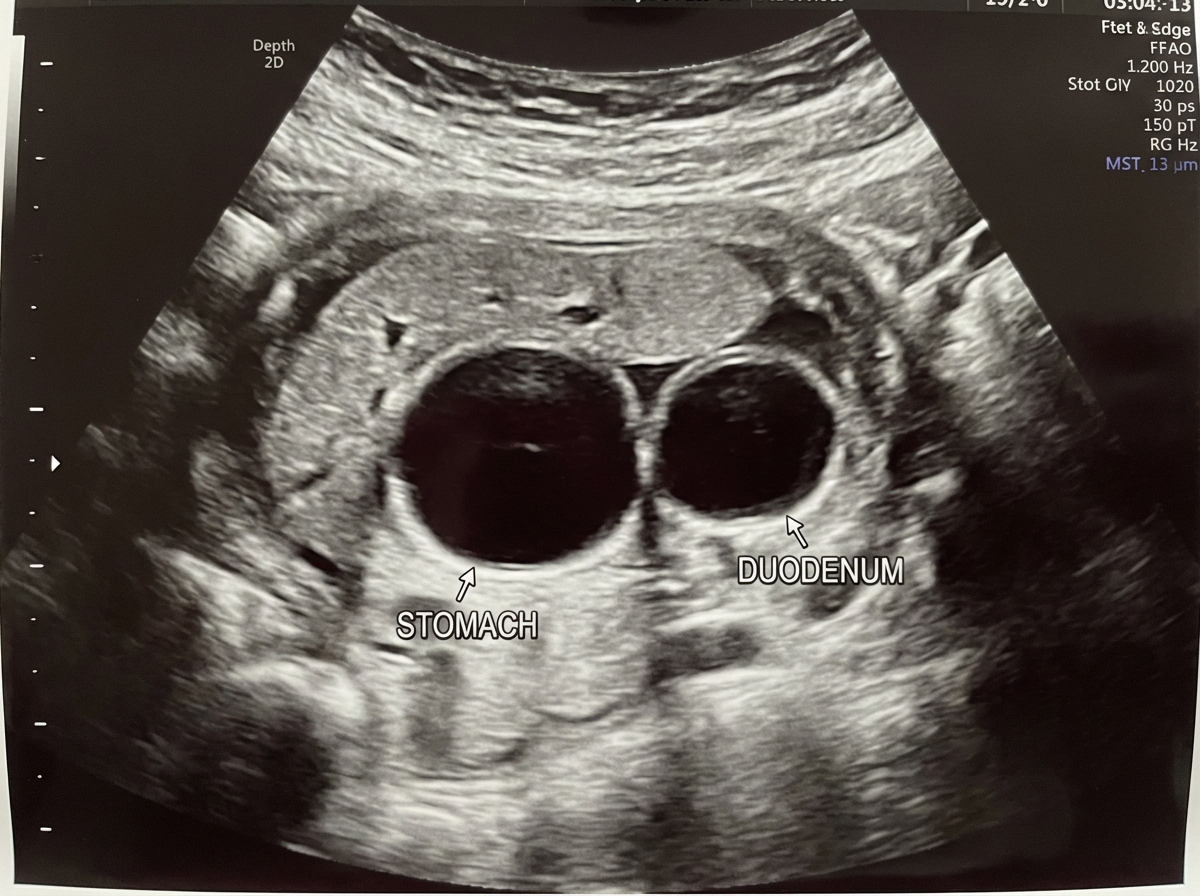 Image for question 158