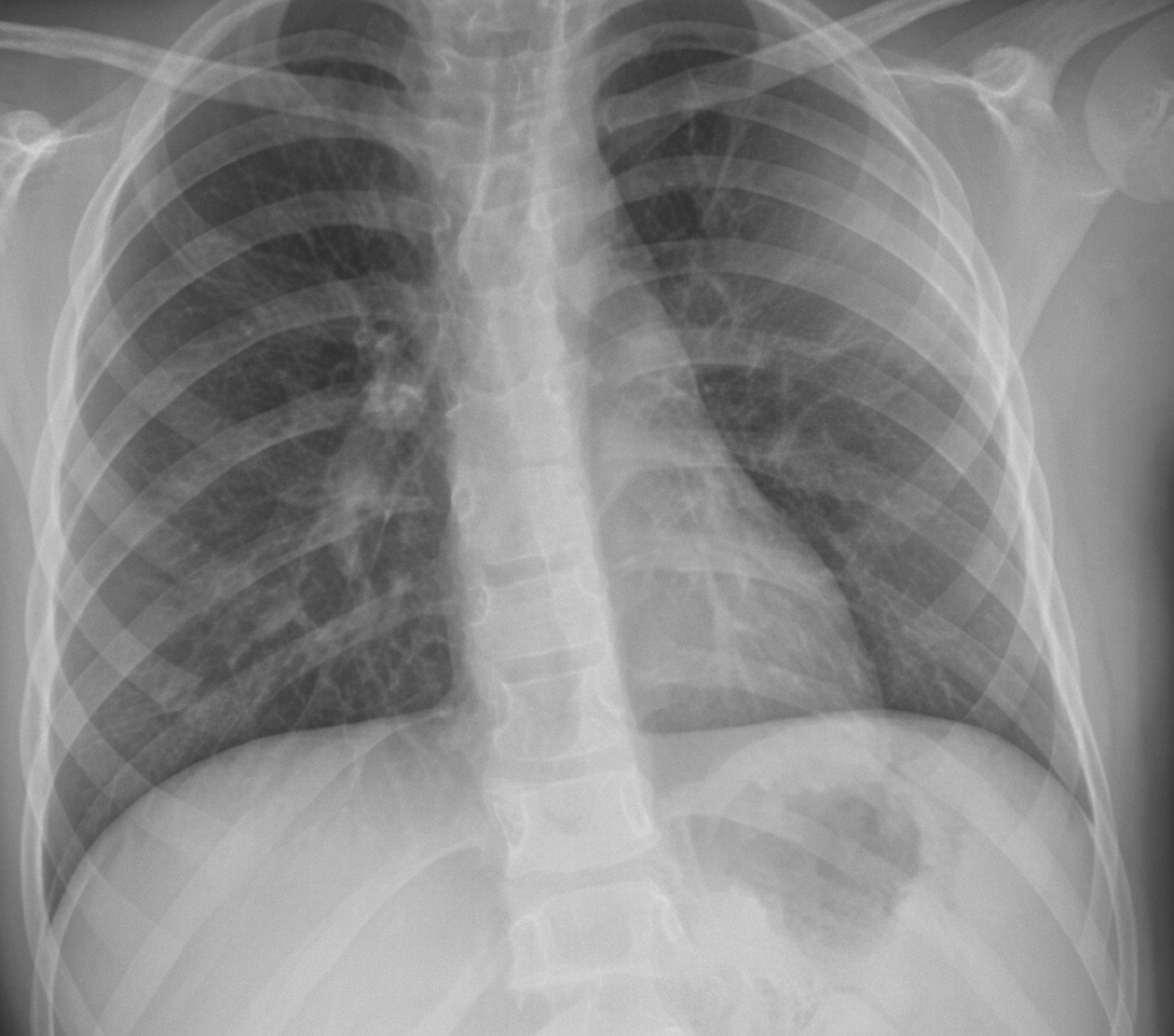 Image for question 117