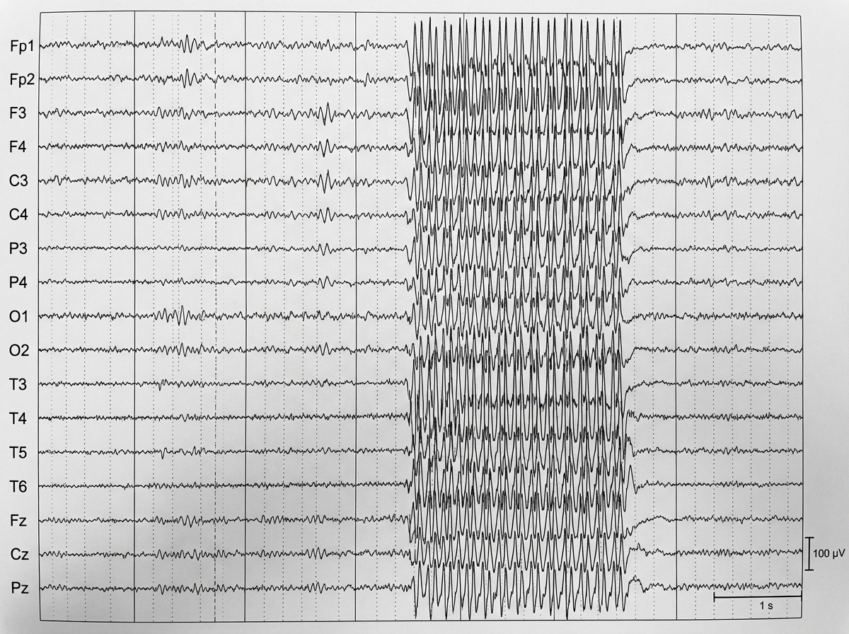 Image for question 135