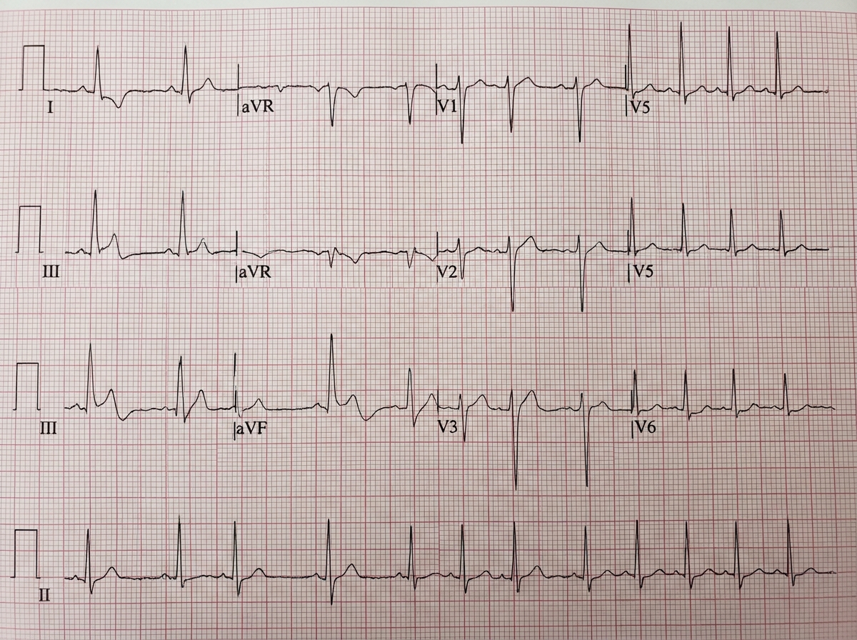 Image for question 19