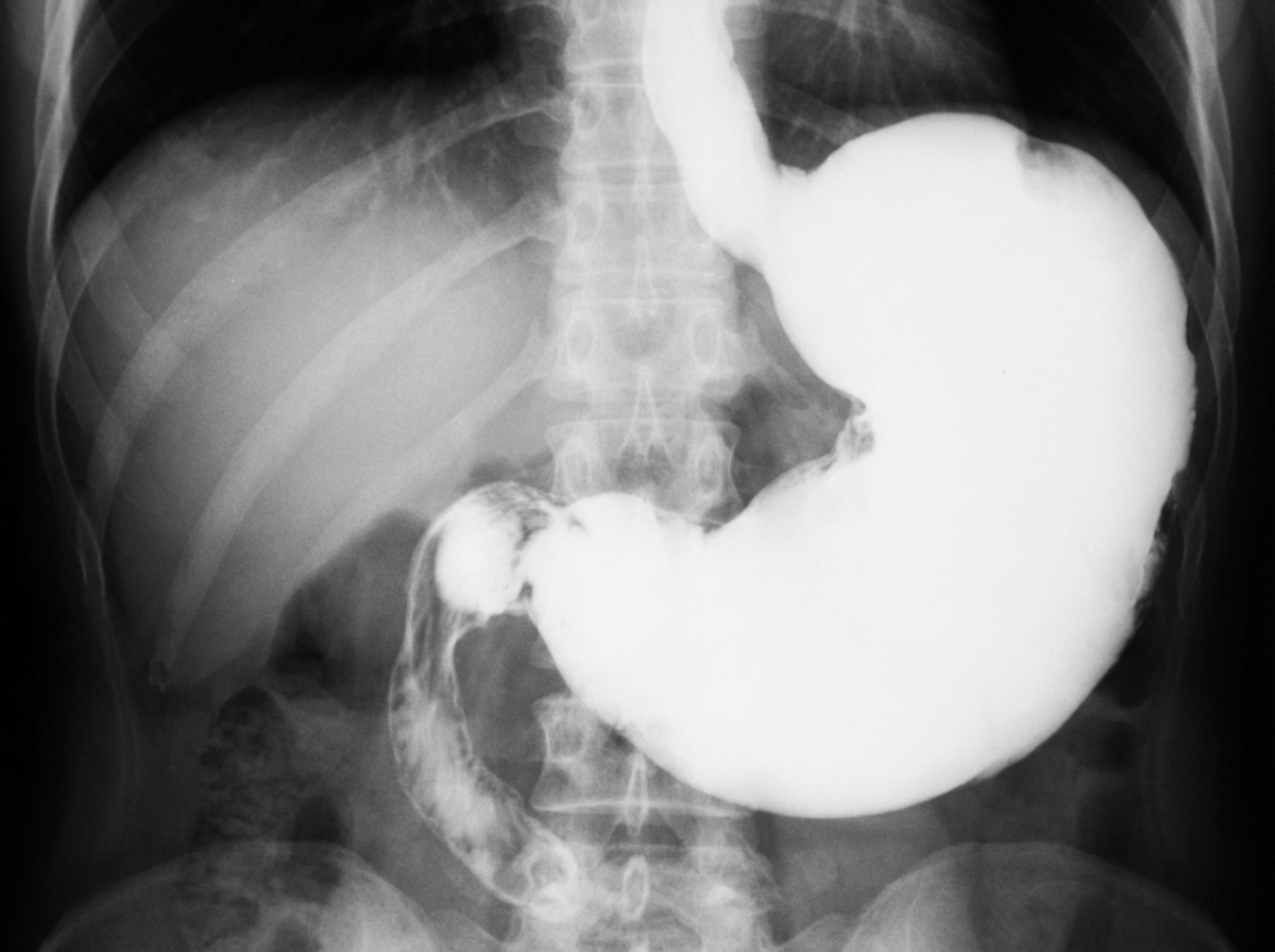 Image for question 794