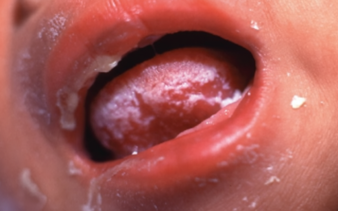 Image for question 235