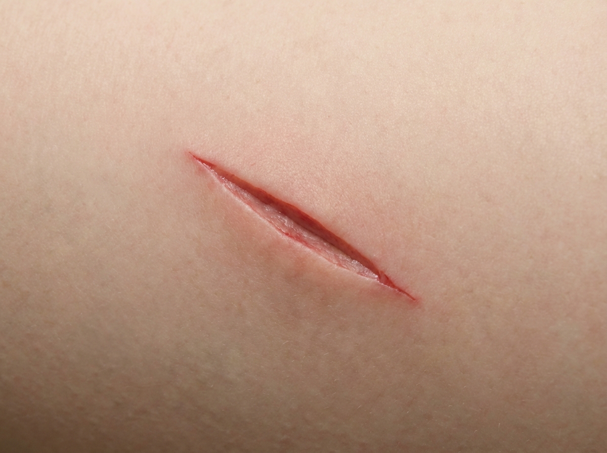 Image for question 115