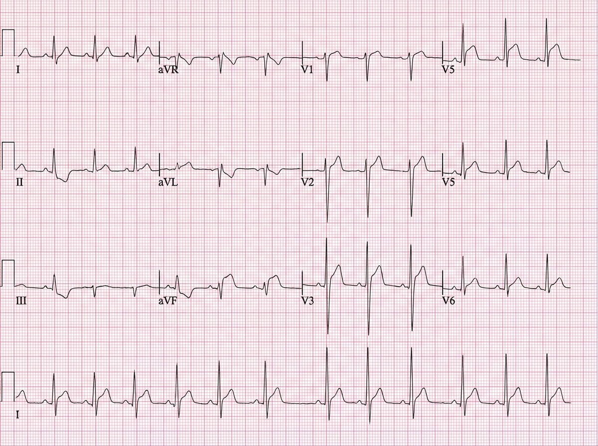 Image for question 206