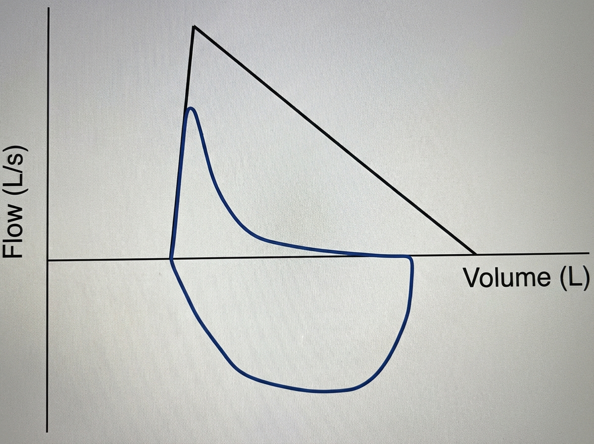 Image for question 1118